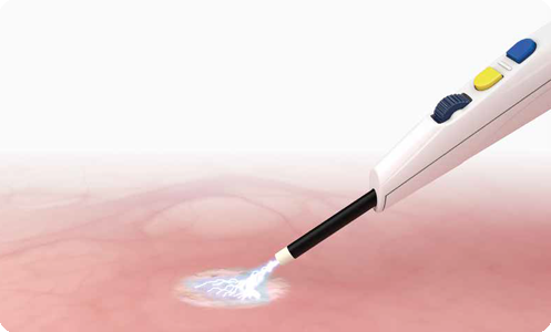 Application with APC